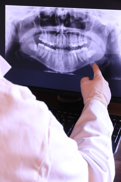 Best Emergency Root Canal Therapy in Middletown, CT