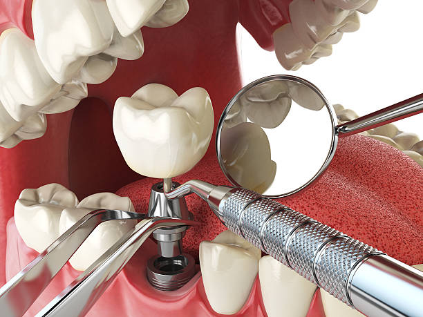 Best Walk-In Emergency Dental Services in Middletown, CT